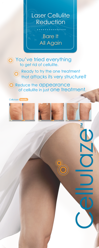 Cellulaze_Patient_Banner_finalHR